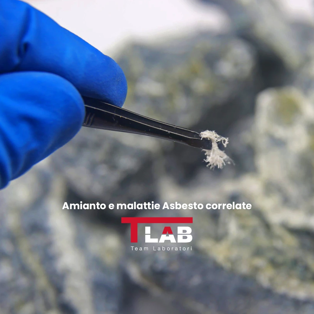 Amianto e malattie Asbesto correlate: Dati INAIL e un approccio scientifico con TLAB